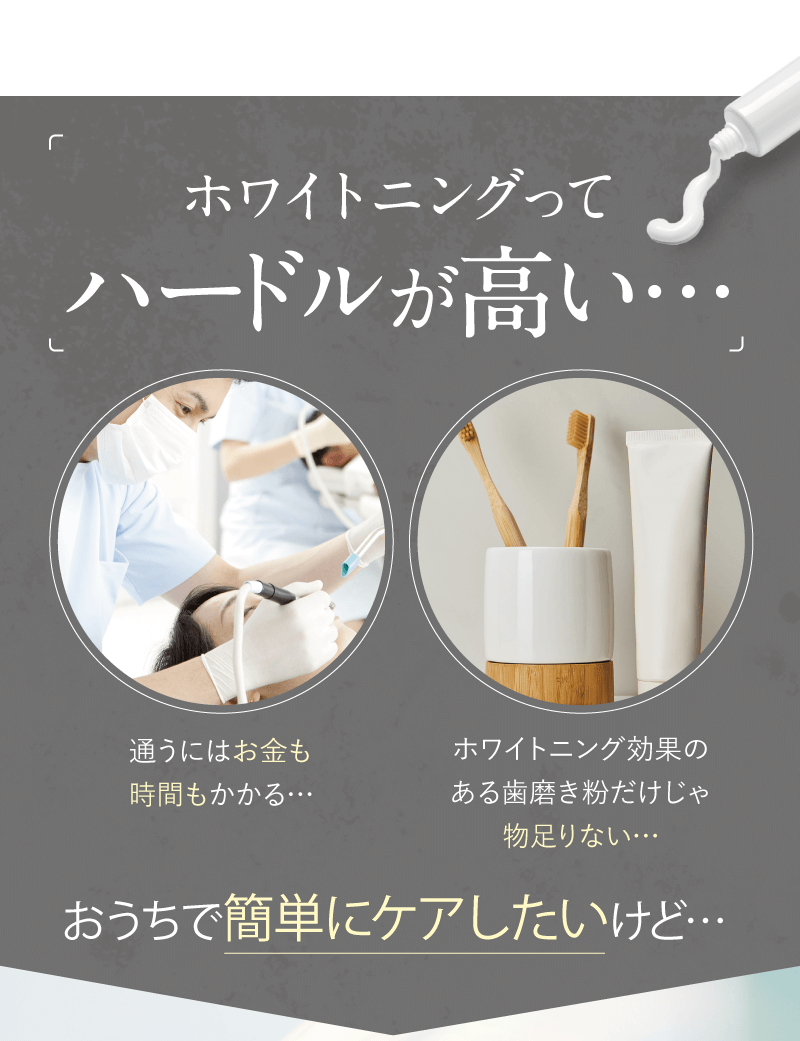 ホワイトニングってハードルが高い…